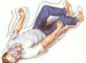 Convulsie
