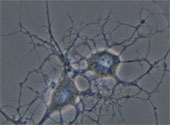 Neuron