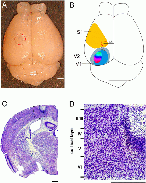 Lowel Greifzu Lowel Greifzu