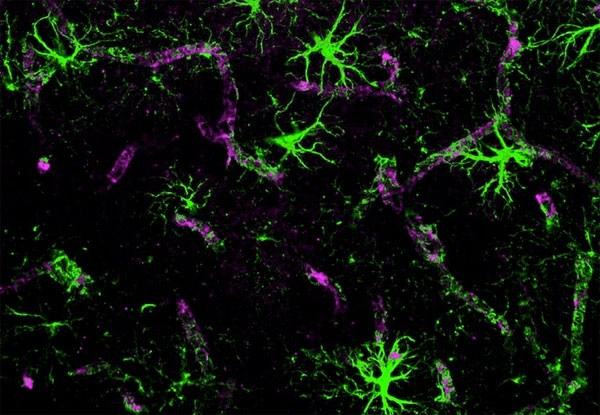 Curăţare creier Curăţare creier