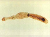 Taenia Echinococcus