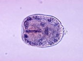 Echinococcus_granulosus_scolex
