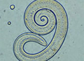 Trichinella spiralis
