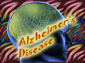 Maladia Alzheimer