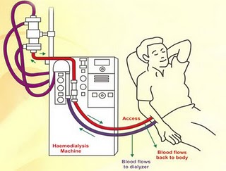 Pacient la hemodializă Pacient la hemodializă