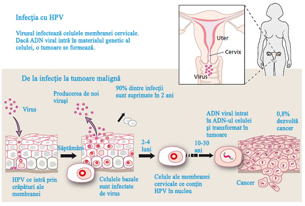 Infectarea cu HPV