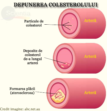 Colesterolul Colesterolul