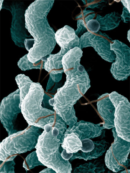 Campylobacter jejuni Campylobacter jejuni